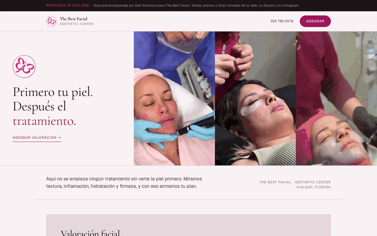 The Best Facial